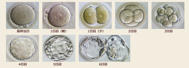 胚（受精卵）
