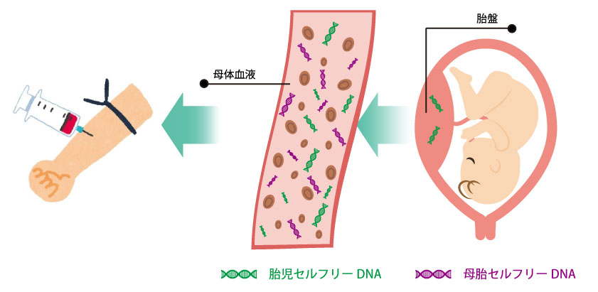 新型出生前診断