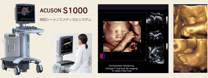 4D超音波診断装置ACUSON S1000